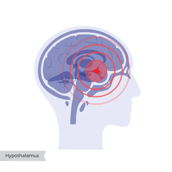 Illustration des Schmerzhirns — Stockvektor