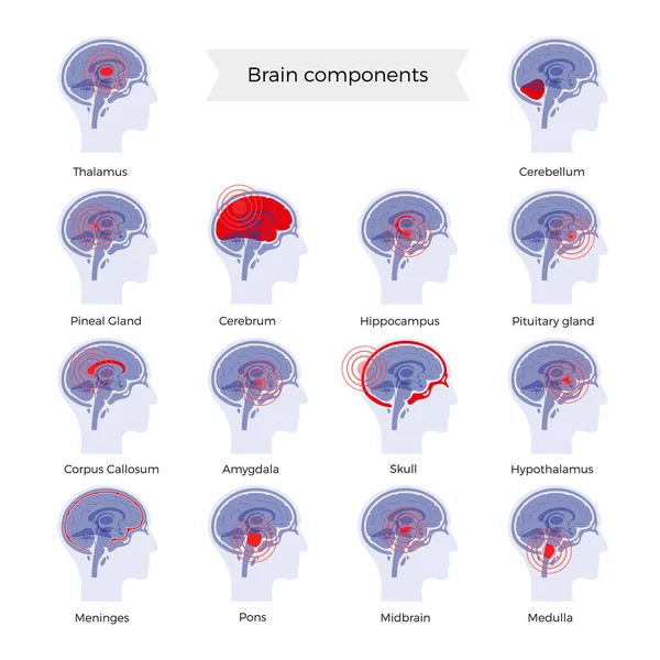 Ilustración del dolor cerebral — Archivo Imágenes Vectoriales