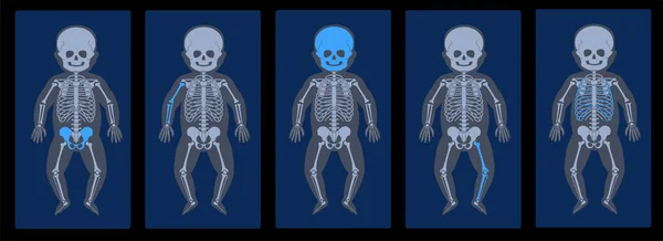 Rayos X de esqueleto — Archivo Imágenes Vectoriales