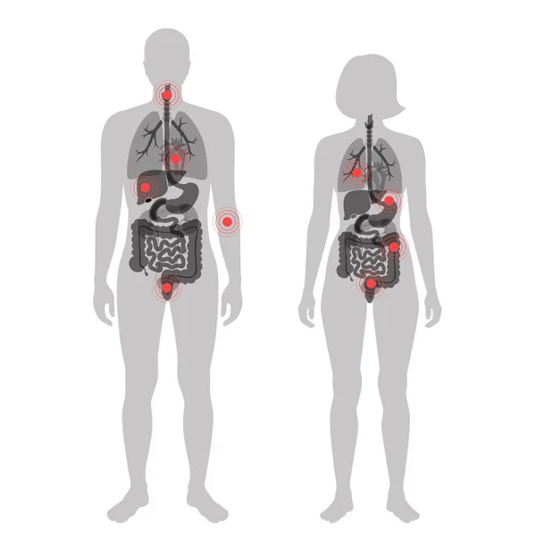 Dor no corpo humano —  Vetores de Stock