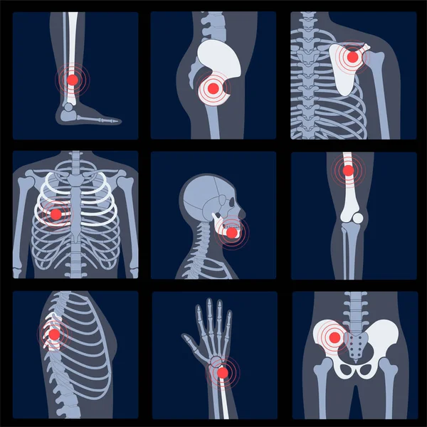 Röntgenfoto van skeletten — Stockvector