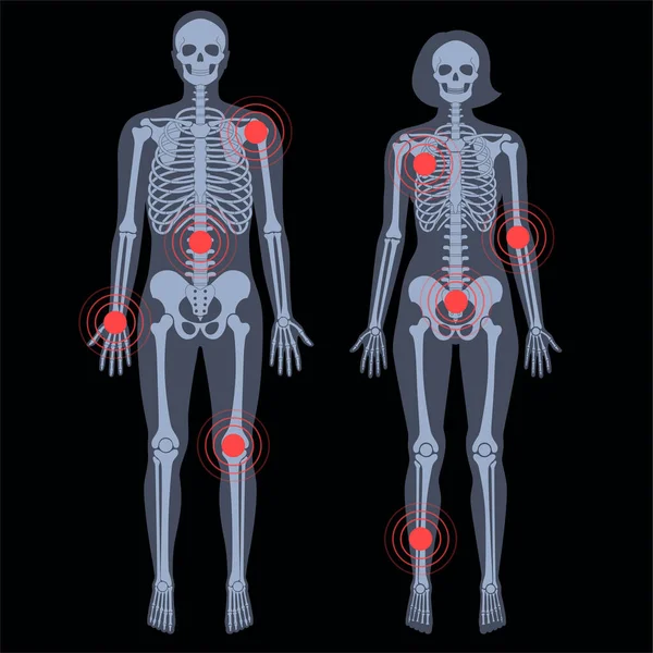 Csontváz-röntgen — Stock Vector