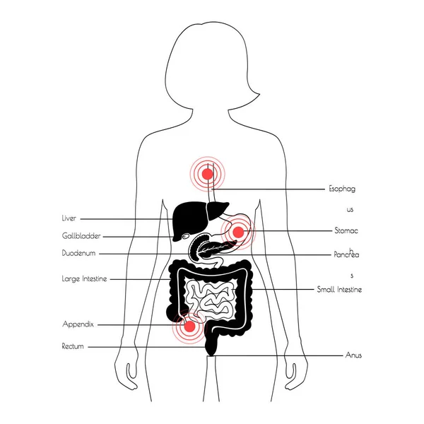 Dolor en el cuerpo humano — Archivo Imágenes Vectoriales