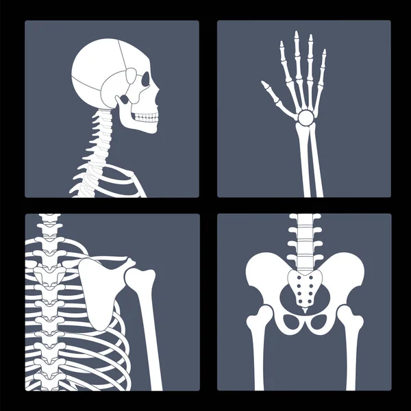 Skeleton x ray — Stock Vector