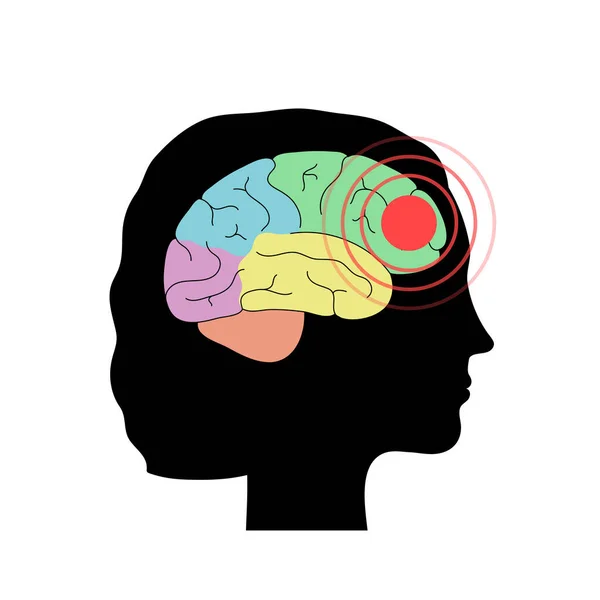 头痛的大脑图解 — 图库矢量图片