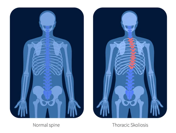 Skeleton x ray — Stockový vektor