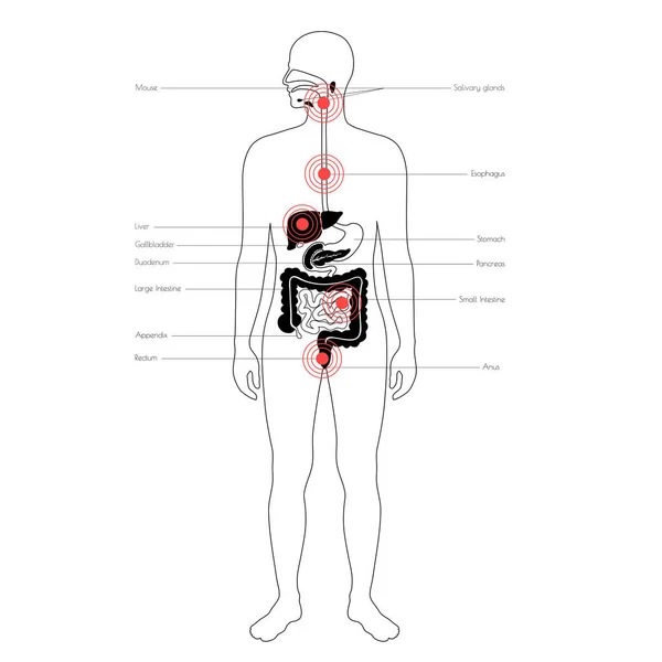 Dolor en el cuerpo humano — Archivo Imágenes Vectoriales