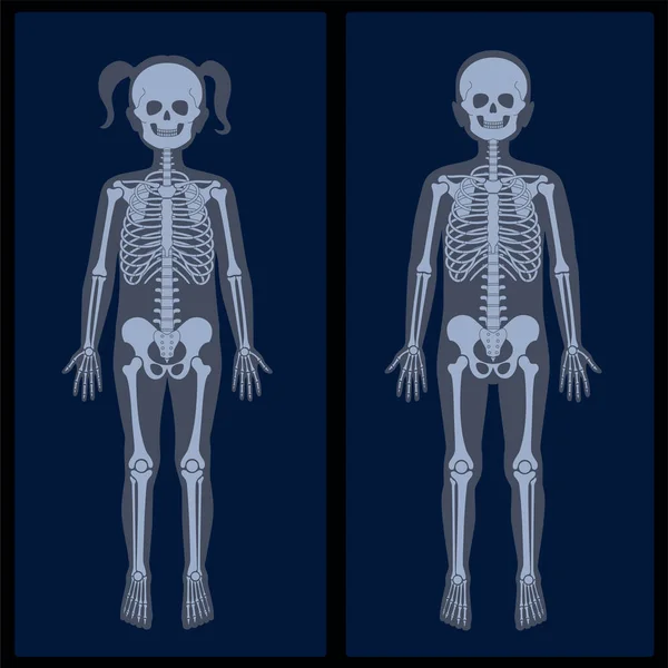 Rayos X de esqueleto — Vector de stock
