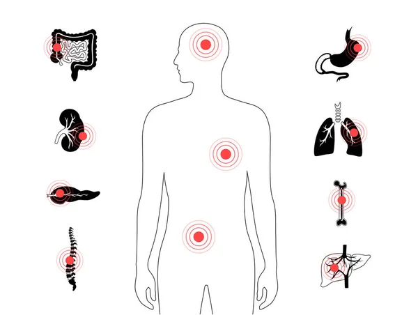 Az emberi test fájdalma — Stock Vector