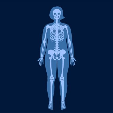 İskelet X ışını