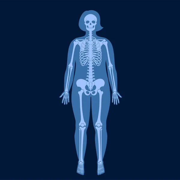 Skelett x ray — Stock vektor