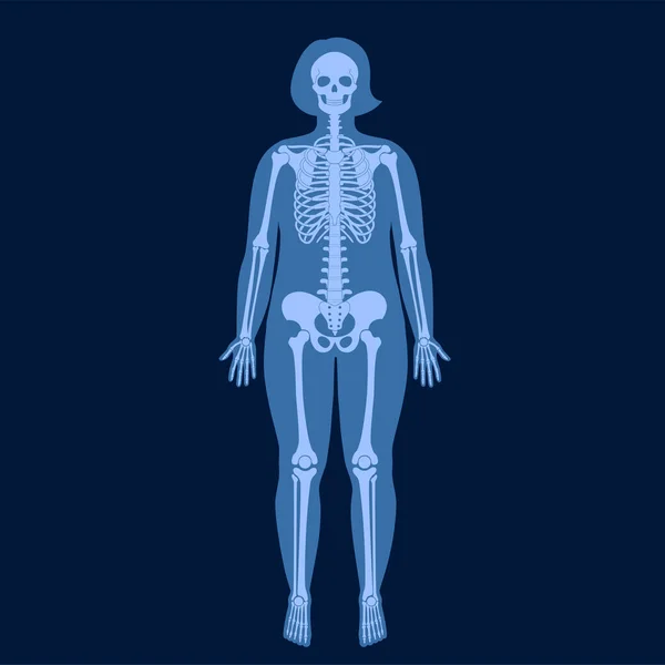 Squelette radiographie — Image vectorielle