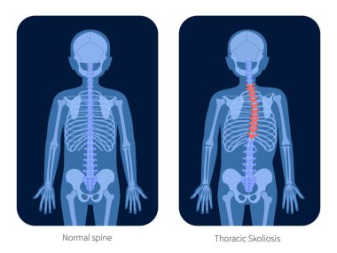 Spine X ray clipart