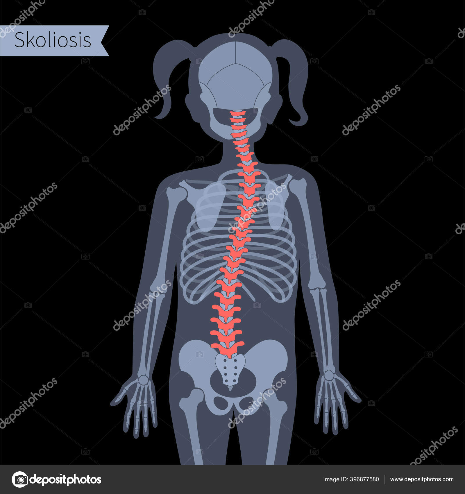 Foto de Xray Ilustração Do Corpo Humano E Esqueleto Feminino e