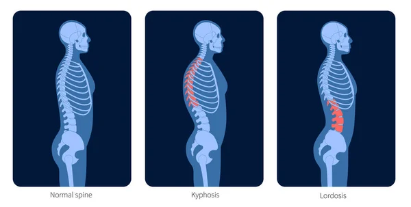 Spine X-ray — стоковый вектор