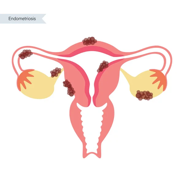 Begreppet mänsklig fertilitet — Stock vektor