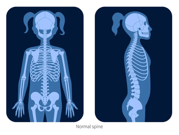 Radiografía de columna vertebral — Vector de stock