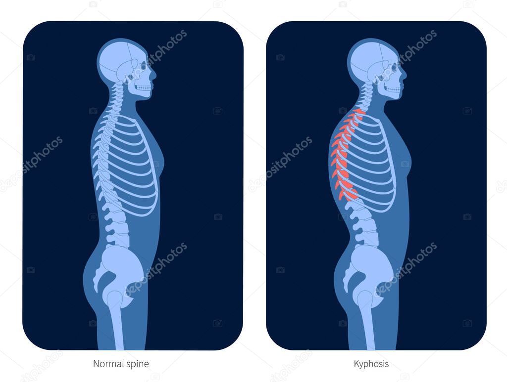 Spine X ray