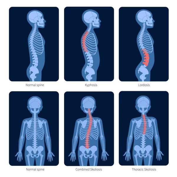 Spine X-ray — стоковый вектор