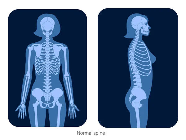 Spine X-ray — стоковый вектор