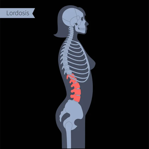 Röntgenbild der Wirbelsäule — Stockvektor
