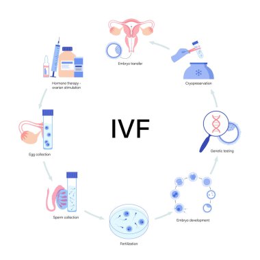 IVF vektör çizimi