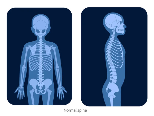 Radiografía de columna vertebral — Vector de stock