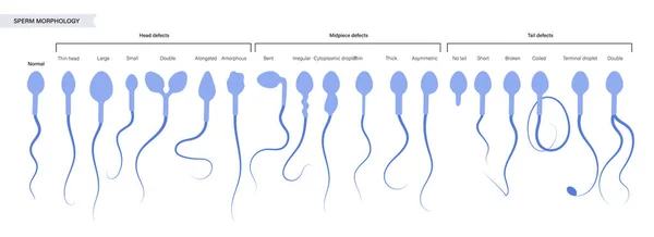 Conceito de fertilidade humana — Vetor de Stock