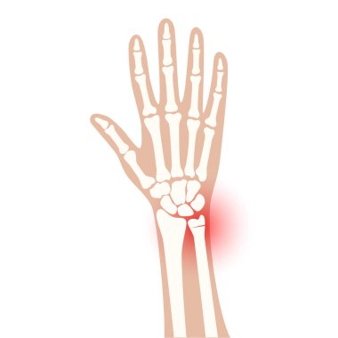 Fraktür x ışını konsepti