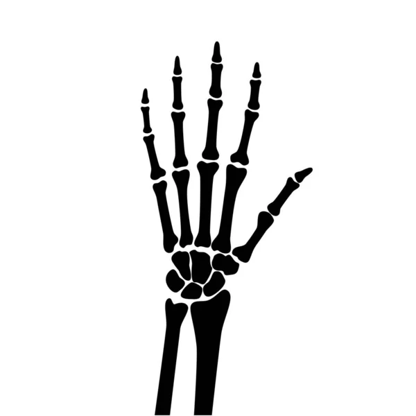 Arthrits x ray - Stok Vektor