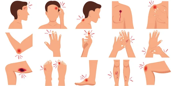 Dolor Las Partes Del Cuerpo Humano Lesión Física Conjunto Plano — Vector de stock