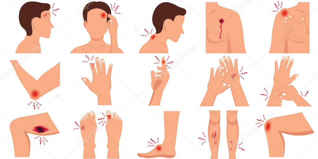 Pain in the human body parts physical injury flat set caused by illness or injury isolated on white background, vector illustration.