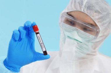 SARS-CoV-2 'nin kan örneğine yakın çekim yapın. Bilim adamının Gözlerinde Pozitif.