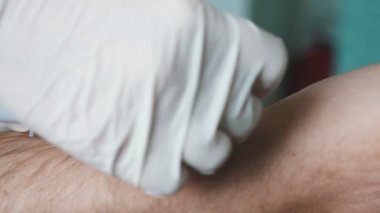 Doktorun elleri hastanın damarına şırınga enjekte ediyor ve kırmızı kan alıyor Doktorun ellerinin beyaz eldivenlerle yakınlaşması bir hastanın eline şırınga iğnesi batırıyor, kan alıyor ve bandaj takıyor.