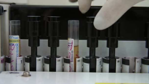 Equipamento Médico Para Análise Sangue Mãos Enfermeira Colocando Tubos Laboratório — Vídeo de Stock