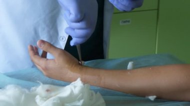 Beyaz üniformalı cerrah, tıp odasında ki bir hastanın elini kontrol ediyor Beyaz üniformalı ve beyaz eldivenler giymiş ortopedik cerrahi uzmanının heyecan verici görüntüsü yalan söyleyen bir hastanın elini kontrol ediyor.