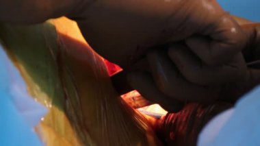 Modern ortopedik odada hastanın kanlı yarasını dürten ıslak parmaklar, ortopedik cerrahi sırasında açık bir kişinin yarasından kırık kemik arayan ıslak ve kıllı cerrahın parmaklarının nefes kesici görüntüsünü