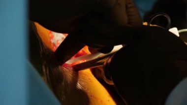 Modern ortopedik odada bir hastanın kanlı delik dürtme kıllı parmaklar ortopedik cerrahi sırasında açık bir kişinin yarası bir şey arayan koyu ve kıllı cerrahın parmaklarının gizemli görünümü
