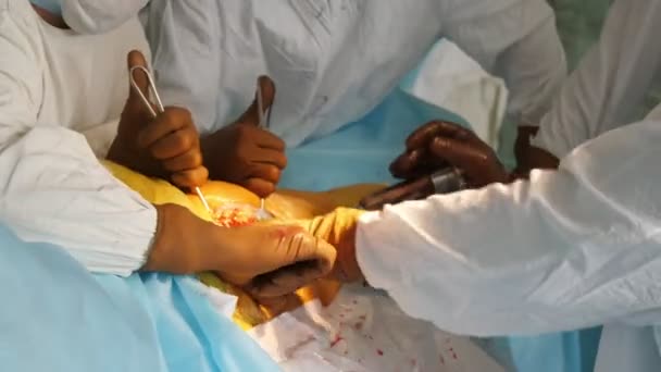 Ομάδα Γιατρών Που Κρατούν Μακρύ Ιατρικό Εργαλείο Ένα Ματωμένο Πόδι — Αρχείο Βίντεο