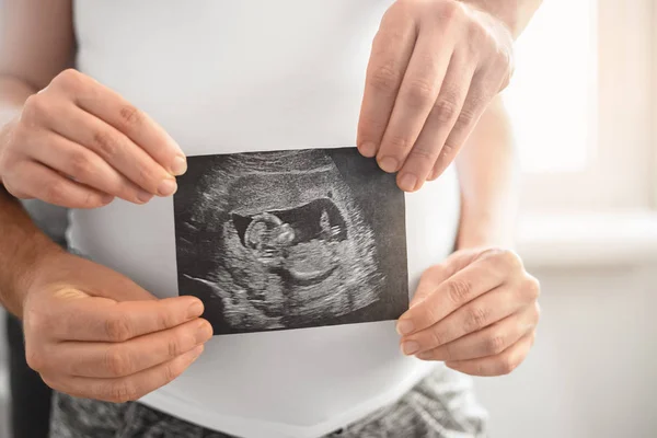 Coppia incinta con ecografia — Foto Stock
