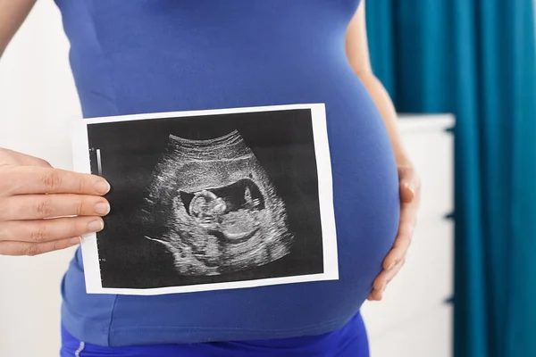 Mujer embarazada sosteniendo ecografía — Foto de Stock