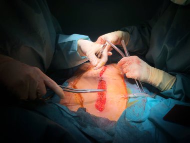 Ameliyat yapan cerrahlar, yakın çekim görünümü.