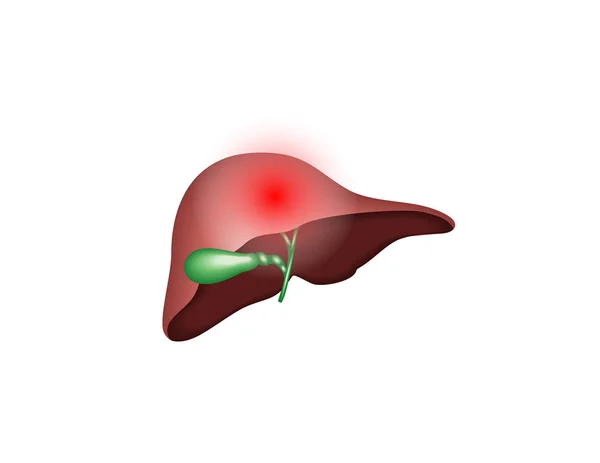 Structura Anatomică Ficatului Uman Vezicii Biliare Fundal Alb — Vector de stoc