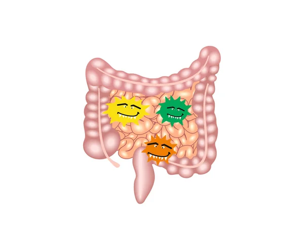 Illustration Menschlicher Darmprobleme Isoliert Auf Weiß — Stockvektor