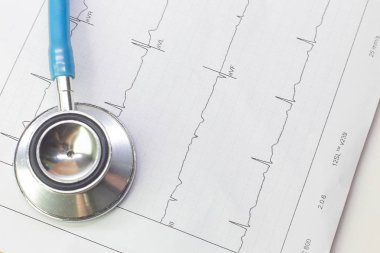Mavi stetoskoplar ve Elektrokardiyografi grafiği görüntüyü kapatın