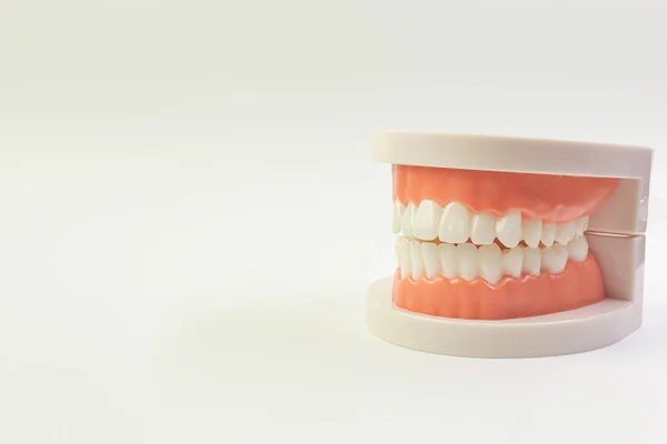 El modelo de dientes sobre fondo blanco para contenido dental . —  Fotos de Stock