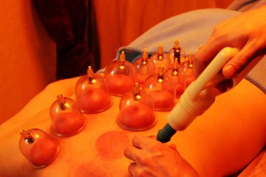 Masaj kutularıyla tedavi edici ve koruyucu masaj ve profesyonel masaj yapan bir adam. raporlama.