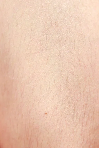 Håriga ben före epilering med långt svart hår. Makro. — Stockfoto