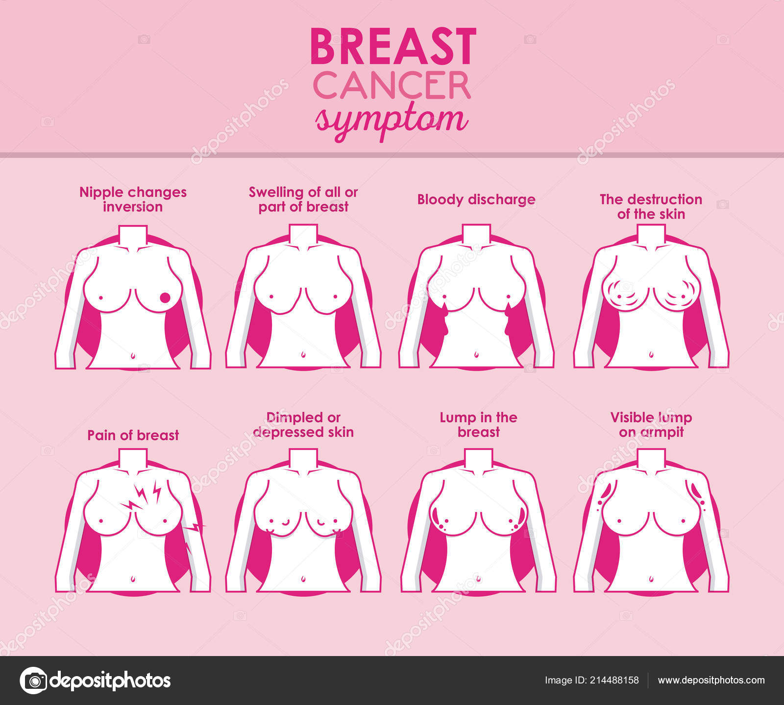 Infografisk brystkreft stockvektor © jemastock #214488158, image size:1600x1440