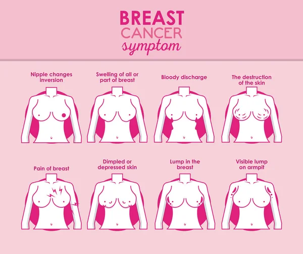 乳癌图表 — 图库矢量图片